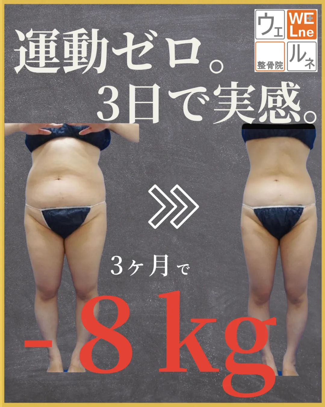 ダイエットをした女性のビフォーアフター